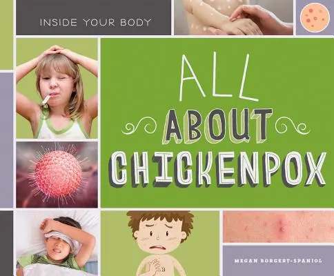 Minden a bárányhimlőről - All about Chickenpox