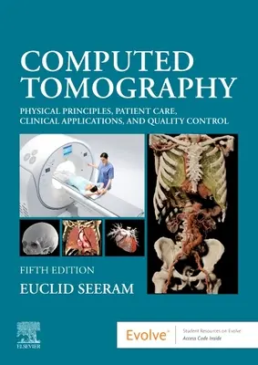 Számítógépes tomográfia: Fizikai alapelvek, betegellátás, klinikai alkalmazások és minőségellenőrzés - Computed Tomography: Physical Principles, Patient Care, Clinical Applications, and Quality Control