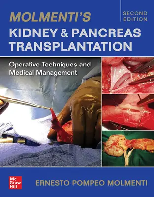 Molmenti's Kidney and Pancreas Transplantation: Operatív technikák és orvosi kezelés - Molmenti's Kidney and Pancreas Transplantation: Operative Techniques and Medical Management