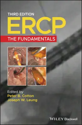 Ercp: Ercpc: Az alapok - Ercp: The Fundamentals