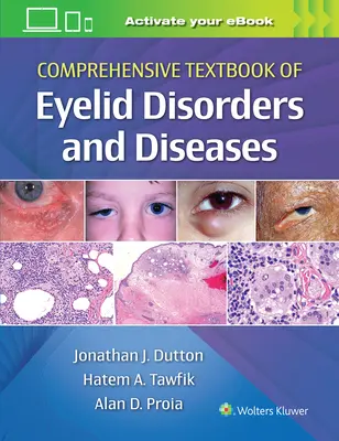 A szemhéjbetegségek és -betegségek átfogó tankönyve - Comprehensive Textbook of Eyelid Disorders and Diseases