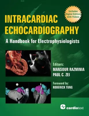 Intrakardiális echokardiográfia: Kézikönyv az elektrofiziológusok számára - Intracardiac Echocardiography: A Handbook for Electrophysiologists