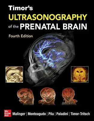 Timor's Ultrasonography of the Prenatal Brain, negyedik kiadás - Timor's Ultrasonography of the Prenatal Brain, Fourth Edition