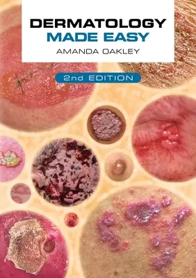 Bőrgyógyászat könnyen érthetően, második kiadás - Dermatology Made Easy, Second Edition