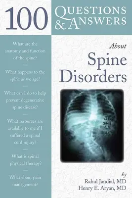 100 kérdés és kérdés a gerincbetegségekről - 100 Q&as about Spine Disorders