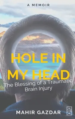 Lyuk a fejemben: Egy traumás agysérülés áldása - Hole in My Head: The Blessing of a Traumatic Brain Injury