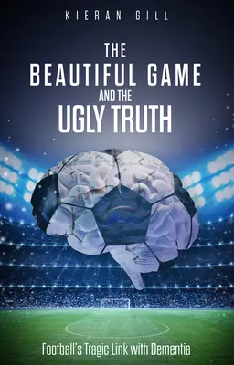 A szép játék és a csúnya igazság: A futball és a demencia tragikus kapcsolata - The Beautiful Game and the Ugly Truth: Football's Tragic Link with Dementia