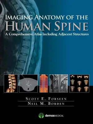 Az emberi gerinc képalkotó anatómiája: Átfogó atlasz a szomszédos struktúrákkal együtt - Imaging Anatomy of the Human Spine: A Comprehensive Atlas Including Adjacent Structures