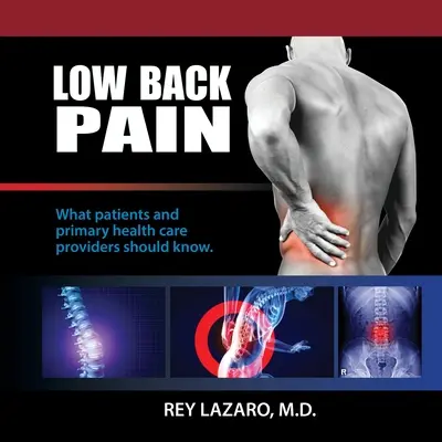 Alacsony hátfájás, Amit a betegeknek és az alapellátást nyújtó egészségügyi szolgáltatóknak tudniuk kell - Low Back Pain, What patients and primary care health care providers should know