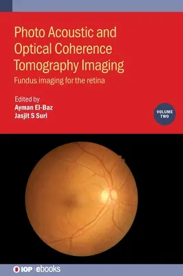 Fotóakusztikus és optikai koherencia-tomográfiás képalkotás, 2. kötet - Photo Acoustic and Optical Coherence Tomography Imaging, Volume 2