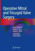 Operatív mitrális és tricuspidális billentyűműtét - Operative Mitral and Tricuspid Valve Surgery