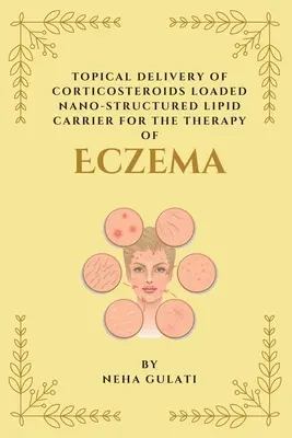 Kortikoszteroidokkal töltött nanoszerkezetű lipidhordozó topikális szállítása az ekcéma terápiájához - Topical Delivery of Corticosteroids Loaded Nanostructured Lipid Carrier for the Therapy of Eczema