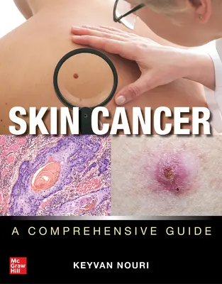 Bőrrák: A Comprehensive Guide - Skin Cancer: A Comprehensive Guide