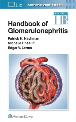 A glomerulonefritisz kézikönyve - Handbook of Glomerulonephritis