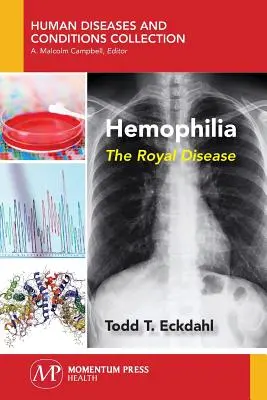 Hemophilia: A királyi betegség - Hemophilia: The Royal Disease