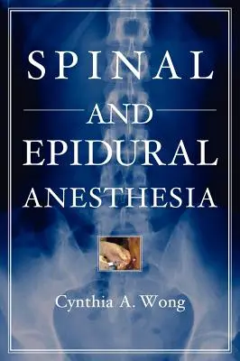 Gerinc- és epidurális érzéstelenítés - Spinal and Epidural Anesthesia