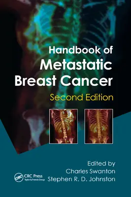 Az áttétes emlőrák kézikönyve - Handbook of Metastatic Breast Cancer