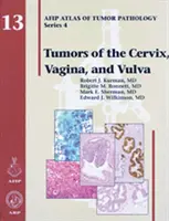 A méhnyak, a vagina és a vulva daganatai - Tumors of the Cervix, Vagina, and Vulva