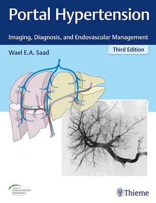 Portál hipertónia: Képalkotás, diagnózis és endovaszkuláris kezelés: Képalkotás, diagnózis és endovaszkuláris kezelés - Portal Hypertension: Imaging, Diagnosis, and Endovascular Management