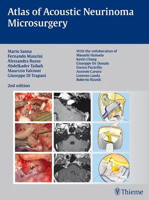 Az akusztikus neurinóma mikrosebészeti atlasza - Atlas of Acoustic Neurinoma Microsurgery