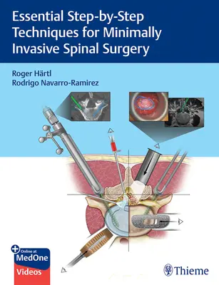 A minimálisan invazív gerincsebészet alapvető lépésről lépésre történő technikái - Essential Step-By-Step Techniques for Minimally Invasive Spinal Surgery