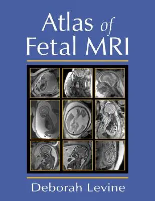 A magzati MRI atlasza - Atlas of Fetal MRI