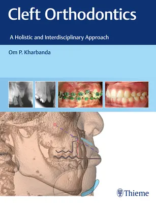 Fogszabályozás: A holisztikus és interdiszciplináris megközelítés - Cleft Orthodontics: A Holistic and Interdisciplinary Approach