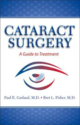 Szürkehályogműtét: A Guide to Treatment - Cataract Surgery: A Guide to Treatment