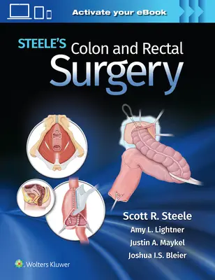 Steele vastagbél- és végbélműtétje - Steele's Colon and Rectal Surgery