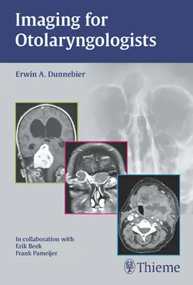 Képalkotás fül-orr-gégészeknek - Imaging for Otolaryngologists