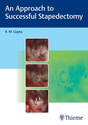 A sikeres stapedektómia megközelítése - An Approach to Successful Stapedectomy