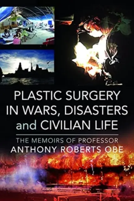 Plasztikai sebészet háborúkban, katasztrófákban és a civil életben: Anthony Roberts OBE professzor emlékiratai - Plastic Surgery in Wars, Disasters and Civilian Life: The Memoirs of Professor Anthony Roberts OBE