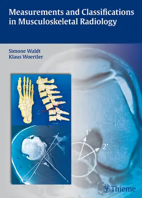 Mérések és osztályozások a mozgásszervi radiológiában - Measurements and Classifications in Musculoskeletal Radiology