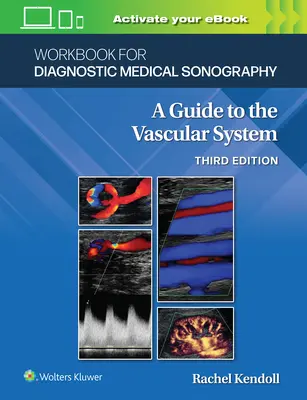 Munkafüzet a diagnosztikai orvosi szonográfiához: Az érrendszeri rendszerek - Workbook for Diagnostic Medical Sonography: The Vascular Systems