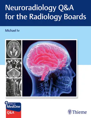 Neuroradiológiai kérdések és válaszok a radiológiai vizsgára - Neuroradiology Q&A for the Radiology Boards