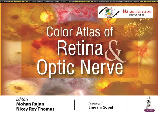 A retina és a látóideg színes atlasza - Color Atlas of Retina & Optic Nerve