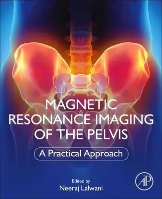 A medence mágneses rezonanciás képalkotása: Gyakorlati megközelítés - Magnetic Resonance Imaging of the Pelvis: A Practical Approach