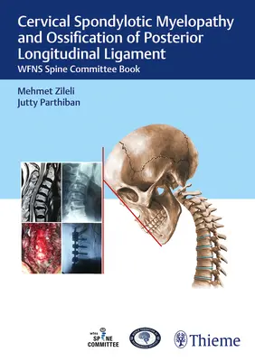 Nyaki spondilotikus myelopátia és a hátsó hosszanti szalag csontosodása: Wfns Spine Committee Book - Cervical Spondylotic Myelopathy and Ossification of Posterior Longitudinal Ligament: Wfns Spine Committee Book