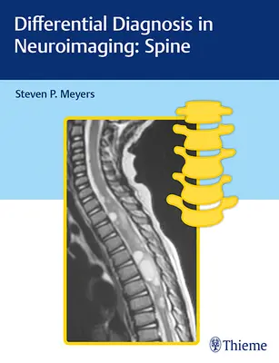 Differenciáldiagnózis az idegrendszeri képalkotásban: Gerinc - Differential Diagnosis in Neuroimaging: Spine