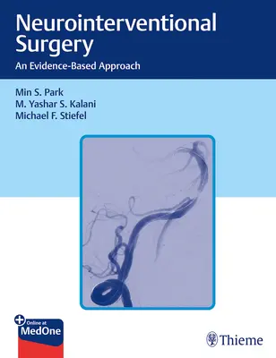 Neurointervenciós sebészet: Bizonyítékon alapuló megközelítés - Neurointerventional Surgery: An Evidence-Based Approach