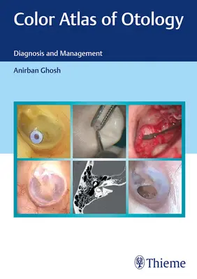 A fülgyógyászat színes atlasza: Diagnózis és kezelés - Color Atlas of Otology: Diagnosis and Management