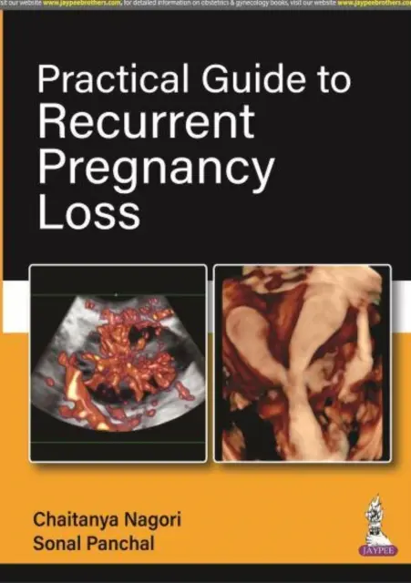 Gyakorlati útmutató a visszatérő terhesség elvesztéséhez - Practical Guide to Recurrent Pregnancy Loss