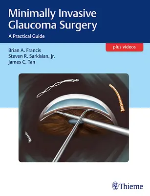 Minimálisan invazív glaukómaműtét: A Practical Guide (Gyakorlati útmutató) - Minimally Invasive Glaucoma Surgery: A Practical Guide