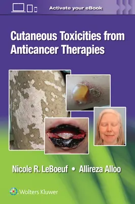 A rákellenes terápiák bőrreakciói - Cutaneous Reactions from Anti-Cancer Therapies