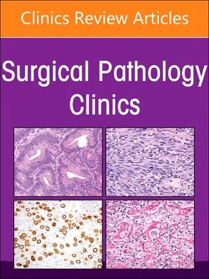 Endokrin patológia, a Sebészeti patológiai klinikák száma: 16-1. kötet - Endocrine Pathology, an Issue of Surgical Pathology Clinics: Volume 16-1