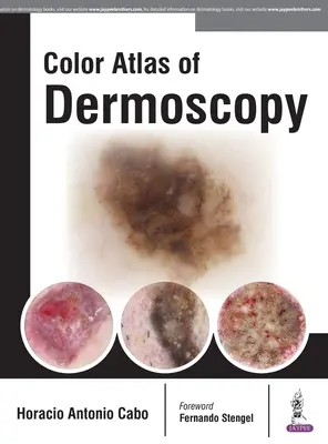 A dermoszkópia színes atlasza - Color Atlas of Dermoscopy