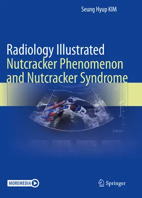 Radiology Illustrated: Diótörő-jelenség és Diótörő-szindróma - Radiology Illustrated: Nutcracker Phenomenon and Nutcracker Syndrome