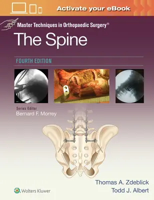 Mestertechnikák az ortopédiai sebészetben: A gerinc - Master Techniques in Orthopaedic Surgery: The Spine