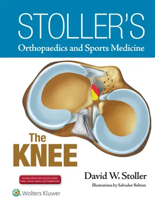 Stoller's Orthopaedics and Sports Medicine: A térd: Stoller előadásvideókat és Stoller jegyzeteket tartalmaz - Stoller's Orthopaedics and Sports Medicine: The Knee: Includes Stoller Lecture Videos and Stoller Notes