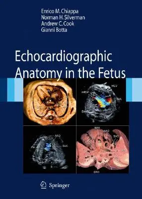 A magzat echokardiográfiás anatómiája [DVD-vel] - Echocardiographic Anatomy in the Fetus [With DVD]